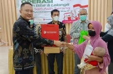 Bank Banten Dan Sari Asih Kolaborasi Tangani Balita Bibir Sumbing Di Banten