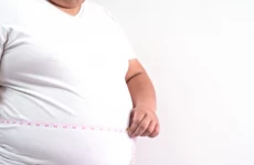 Faktor Penyebab Seseorang Menderita Obesitas